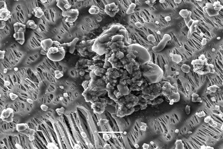 Organic material in dust particles under the scanning electron microscope | Source: © ZALF